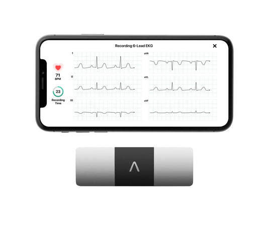 KardiaMobile 6L Personal EKG Monitor with Most Smartphones